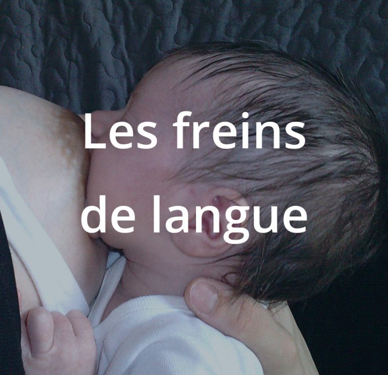 Les freins de langue anatomie, retentissement sur la succion, évaluation, stratégies